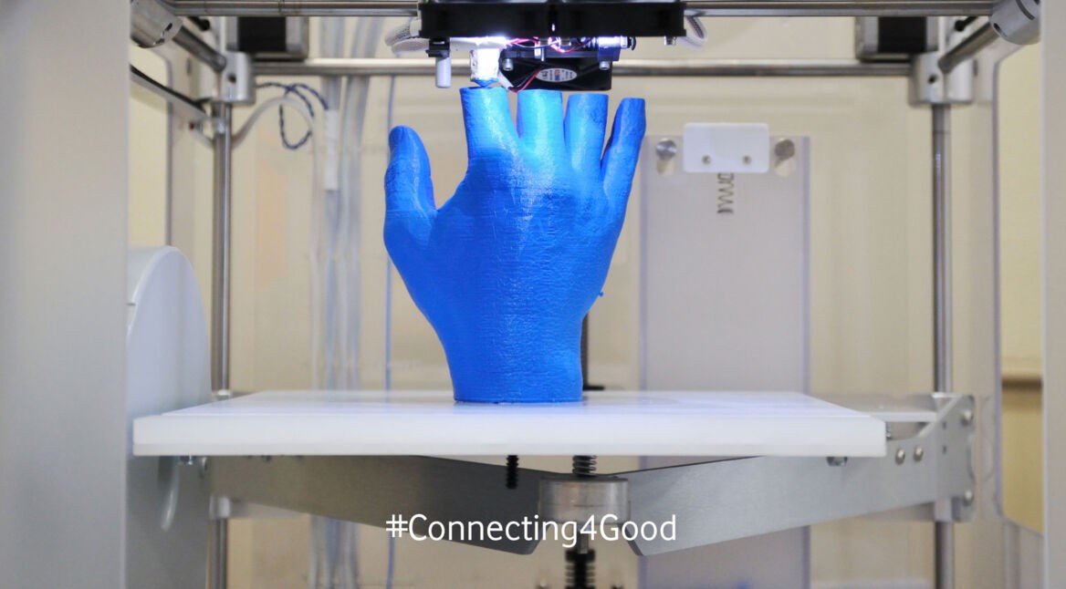 Handprothese-aus-dem-3D-Drucker