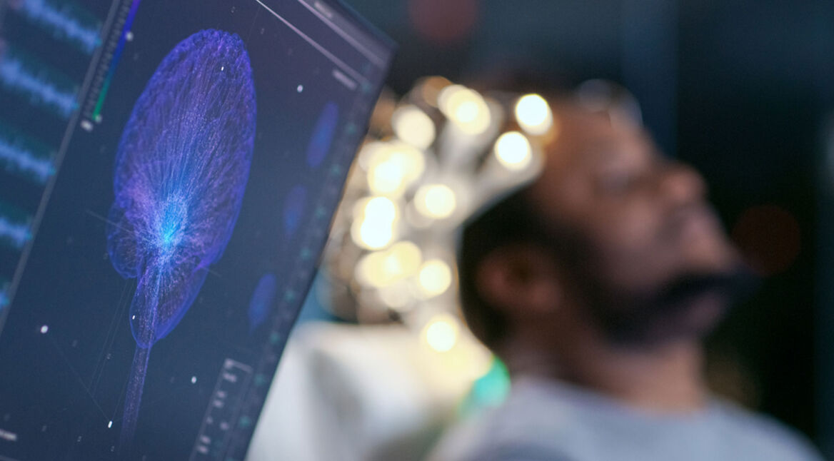 Forscher haben verschiedene Ansätze entwickelt, Sprache aus Hirnströmen zu rekonstruieren.