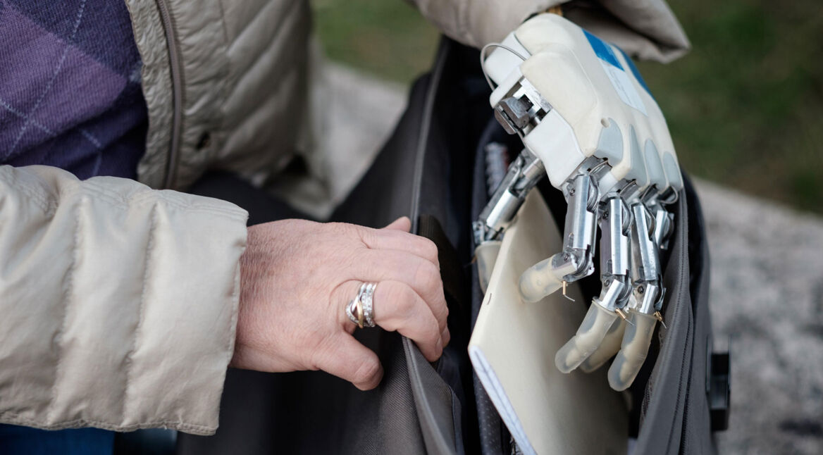 Bionische Handprothese