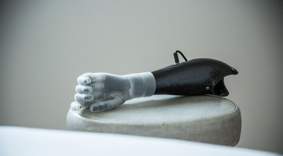 Künstliche-Hand-7