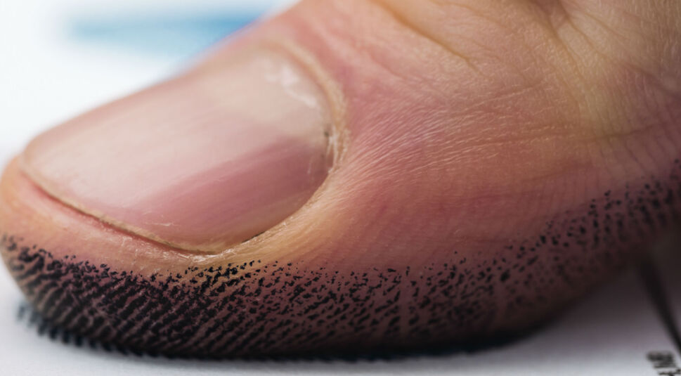 Viele Smartphones lassen sich auch via Fingerabdruck entsperren.