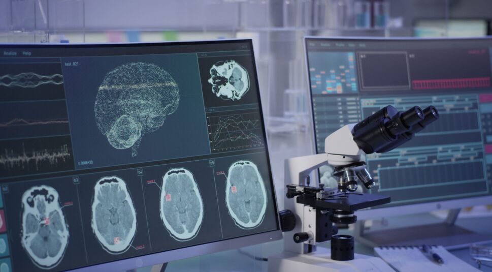 KI in der Medizin kann helfen Diagnosen präzise zu stellen