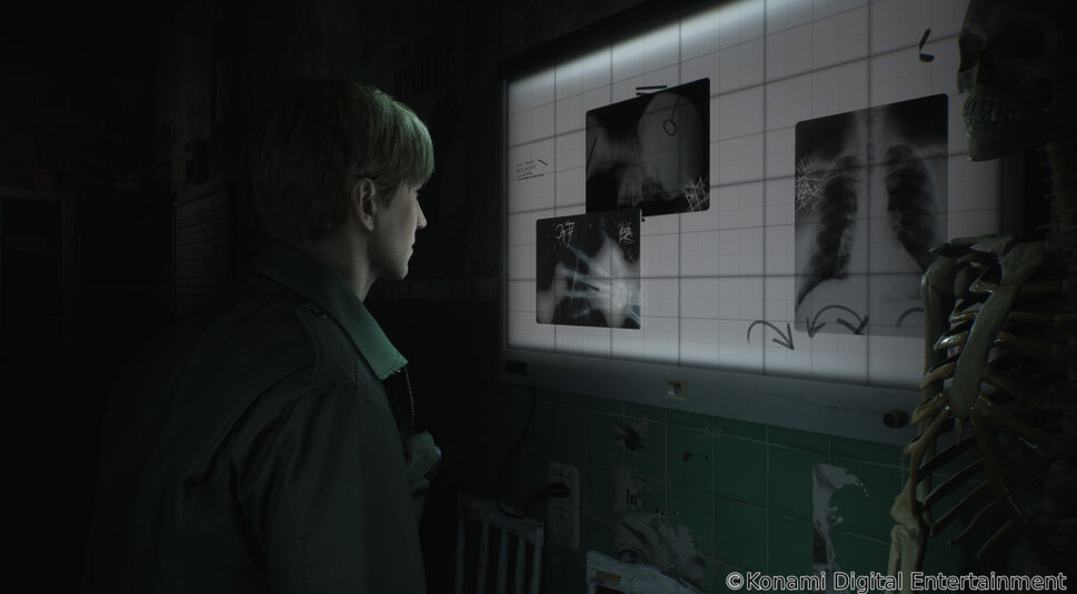 James Sunderland steht vor Röntgenbilder