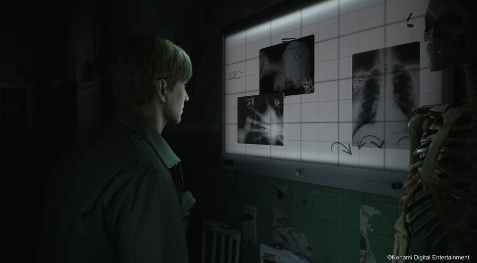 In diesem Bild aus dem "Silent Hill 2 Remake im Test" betrachtet James Sunderland, bekleidet mit einem grünen Mantel, aufmerksam einige Röntgenbilder an einer beleuchteten Wand. Rechts neben ihm steht ein menschliches Skelett, das die unheimliche Atmosphäre des Raums verstärkt. Die Röntgenbilder zeigen Knochen und Lungen, die mit Pfeilen markiert sind, was auf medizinische oder bedrohliche Hinweise hindeuten könnte. Die düstere Beleuchtung und der morbide Raum schaffen eine bedrückende und mysteriöse Stimmung.