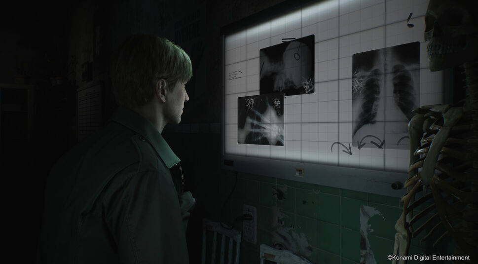 Auf dem Artikelbild vom Silent Hill 2 Remake-Tipps-Artikel ist der Protagonist James Sunderland zu sehen, wie er in einem düsteren Raum vor einer beleuchteten Röntgenbildtafel steht. Er betrachtet mehrere Röntgenaufnahmen, die teilweise mit Pfeilen markiert sind. Rechts von ihm ist ein menschliches Skelett zu sehen, was die unheimliche Atmosphäre verstärkt. Der Raum wirkt heruntergekommen und verleiht der Szene einen gruseligen, verlassenen Eindruck.